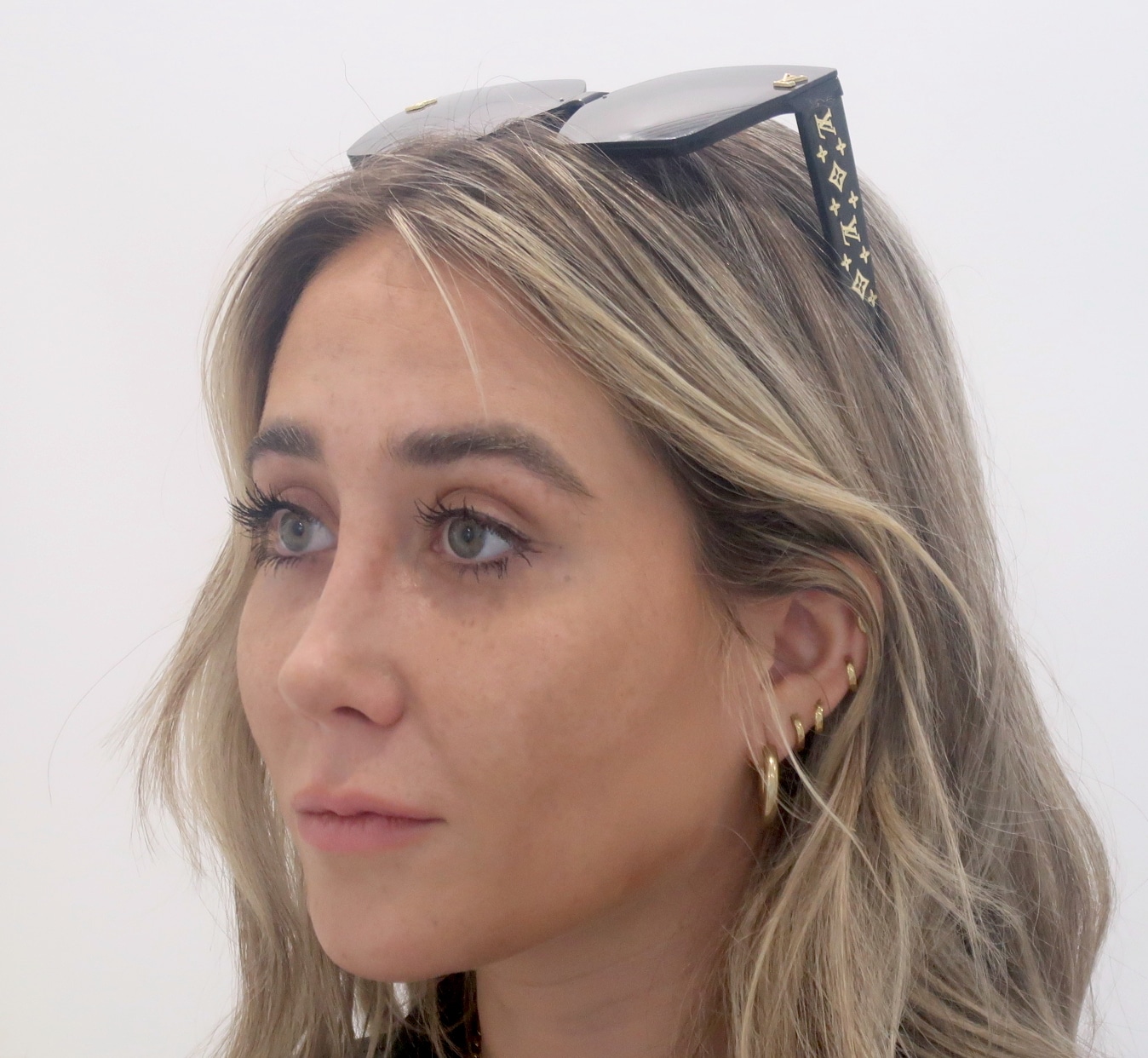 rinoplastia clara Tres quarts pre