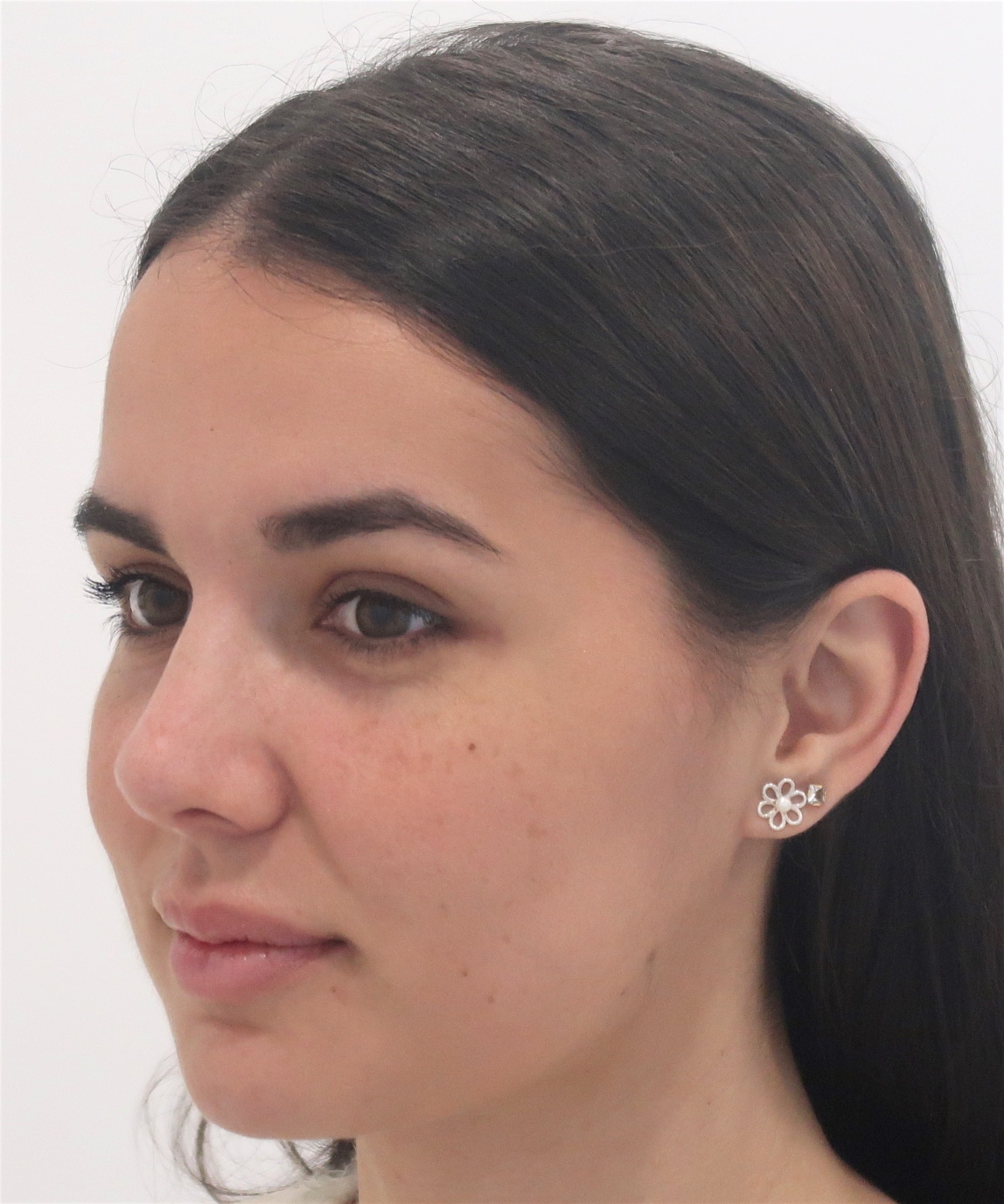rinoplastia janet tres quarts post