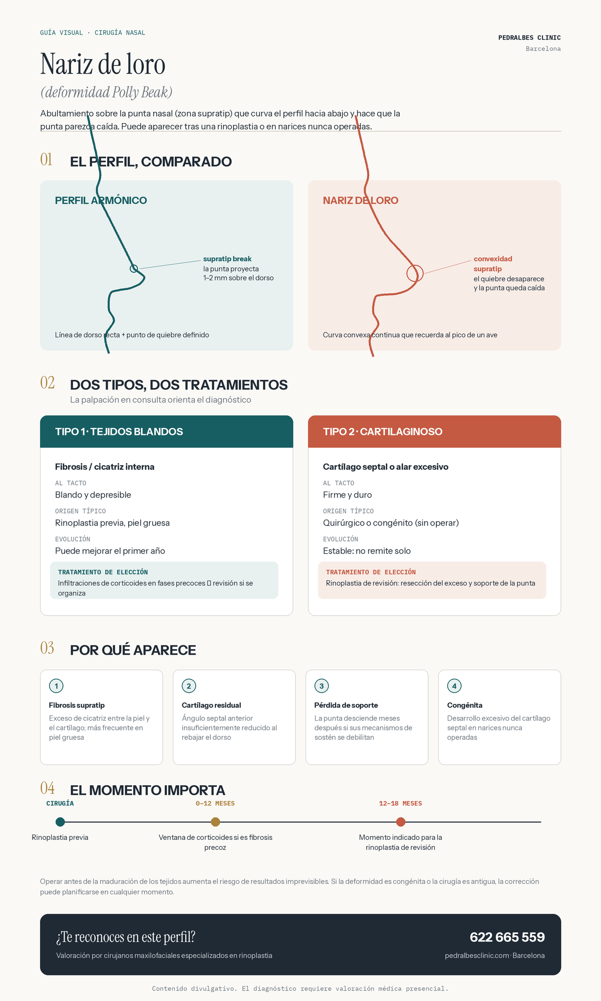 infografia-nariz-de-loro-pedralbes-clinic